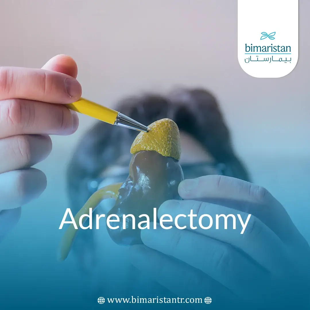 Adrenalectomy: Procedure, Benefits &Amp;Amp; Hormonal Impact