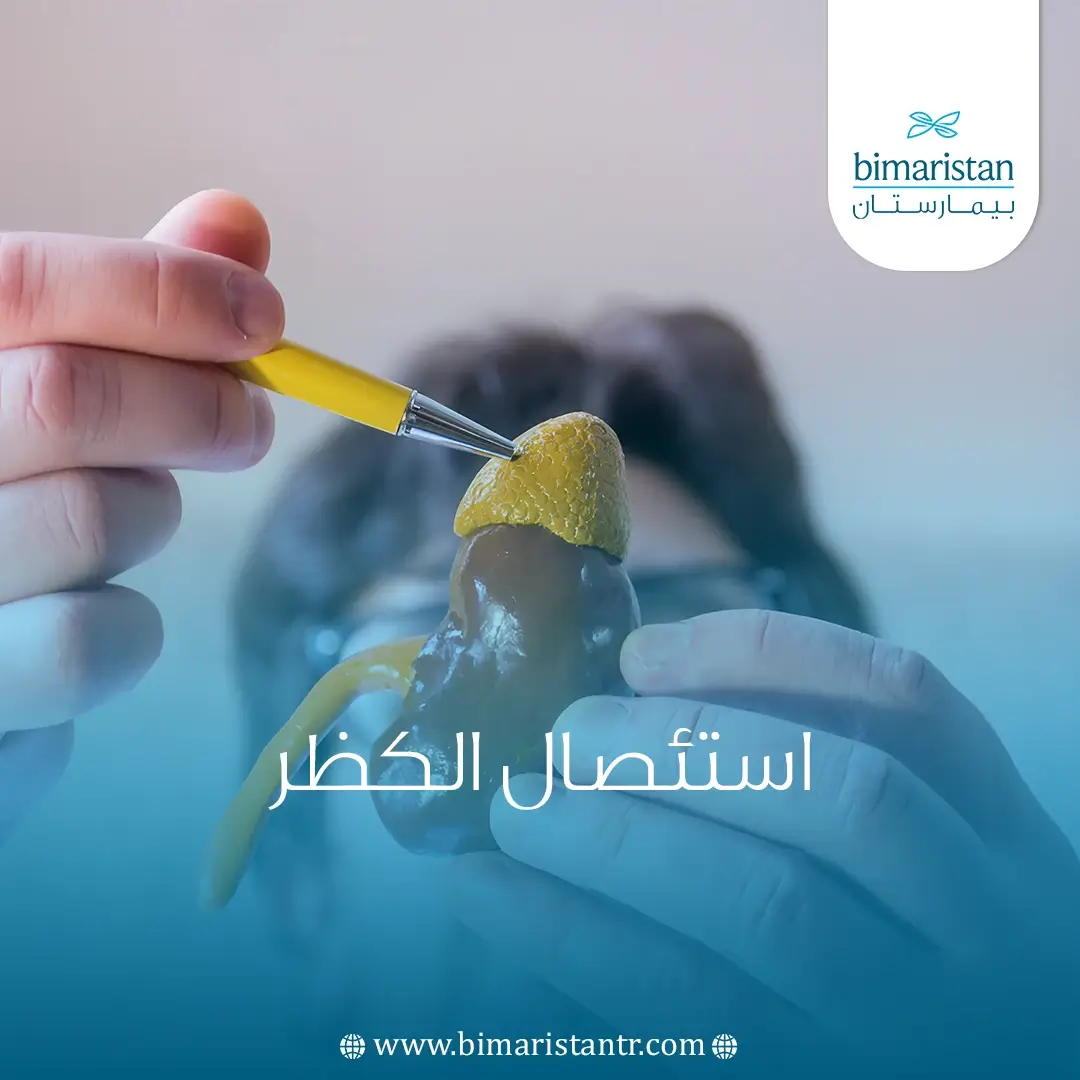 استئصال الكظر