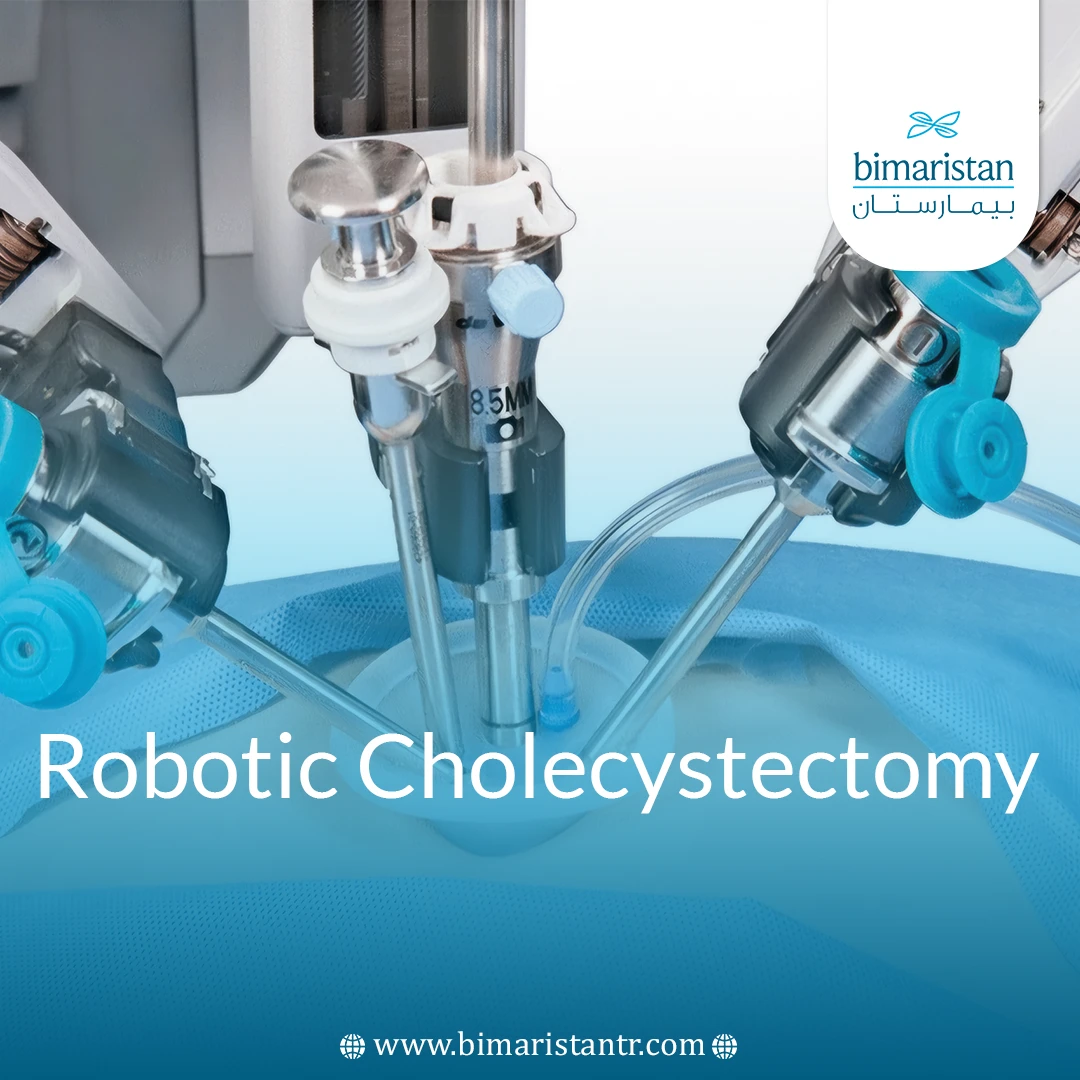 Robotic Cholecystectomy