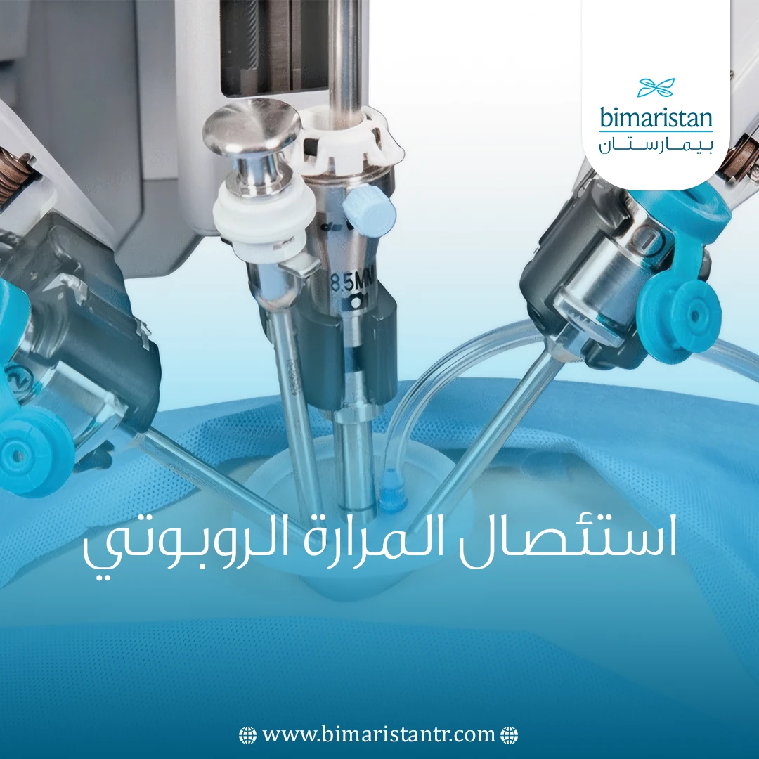 استئصال المرارة الروبوتي