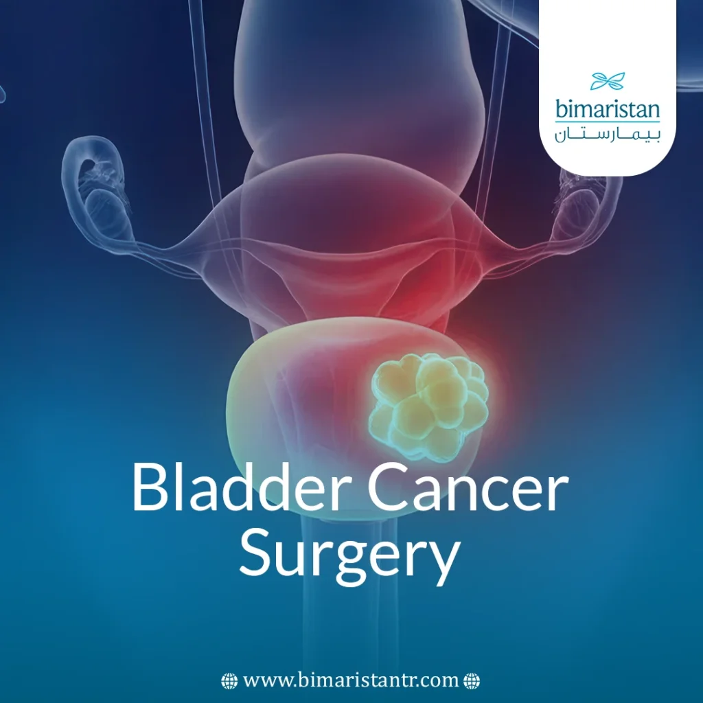 Bladder Cancer Surgery: When It'S Done &Amp; What Risks Involve
