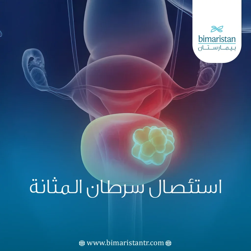 استئصال سرطان المثانة