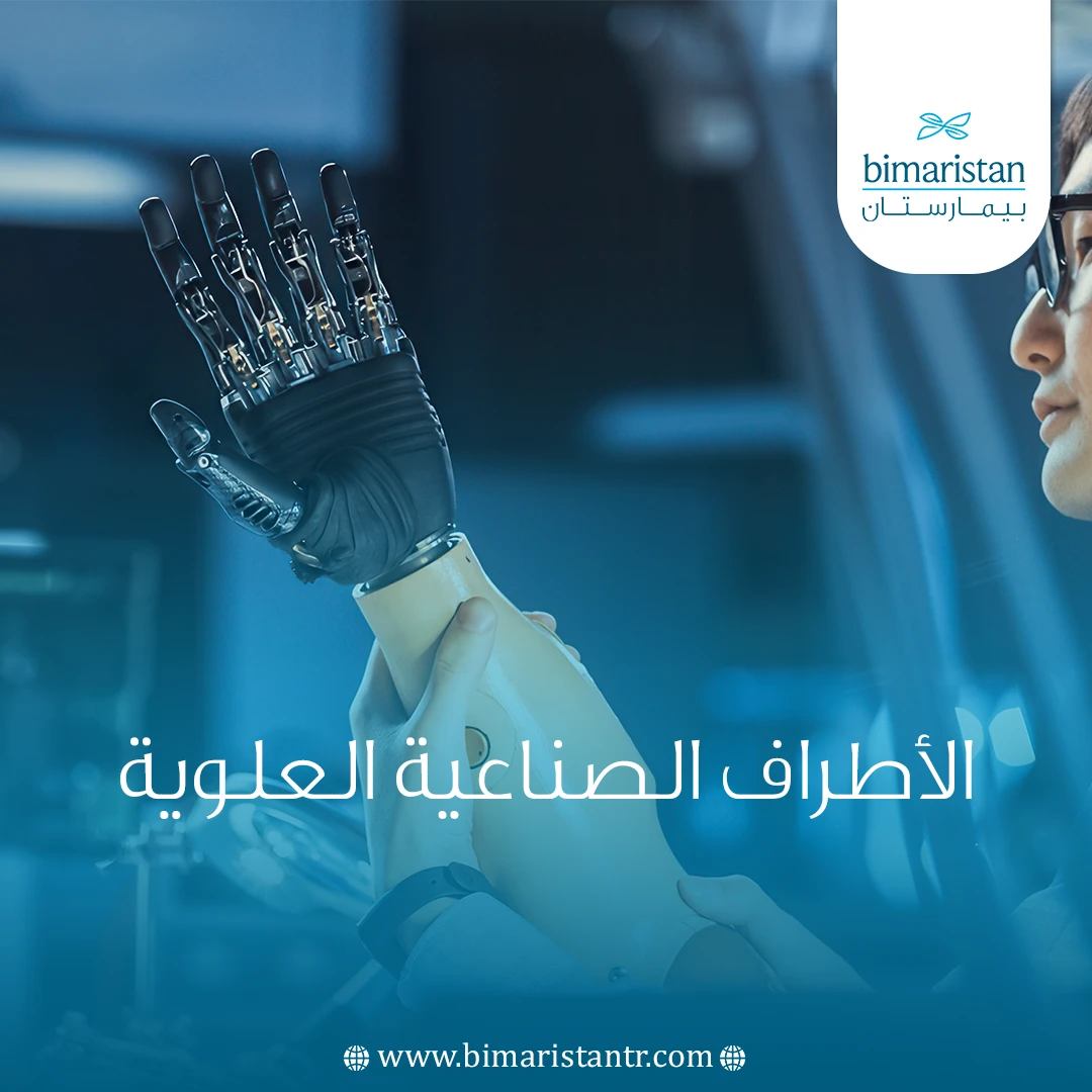 الأطراف الصناعية العلوية