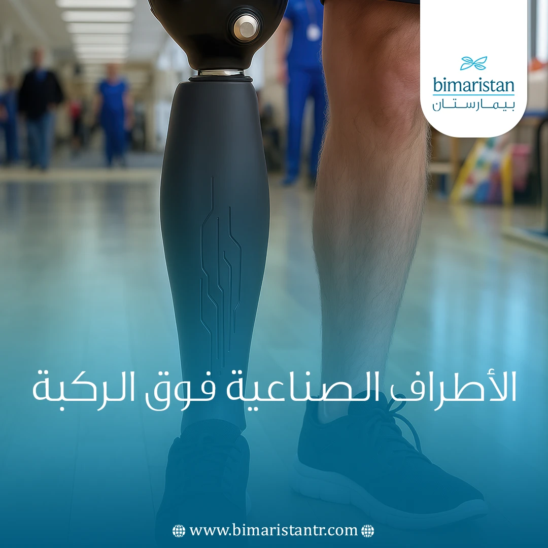الأطراف الصناعية فوق الركبة