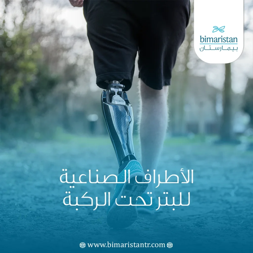 الأطراف الصناعية للبتر تحت الركبة