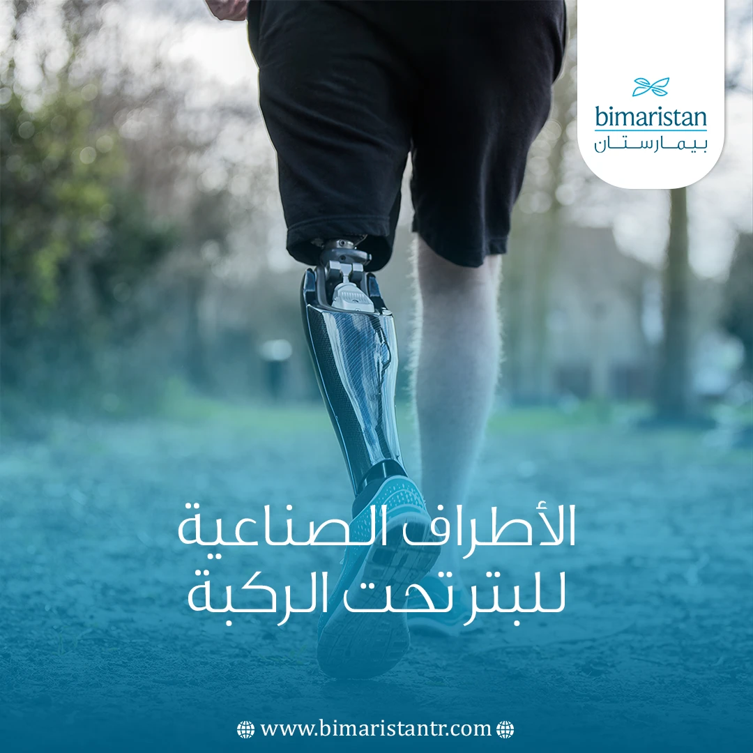 الأطراف الصناعية للبتر تحت الركبة