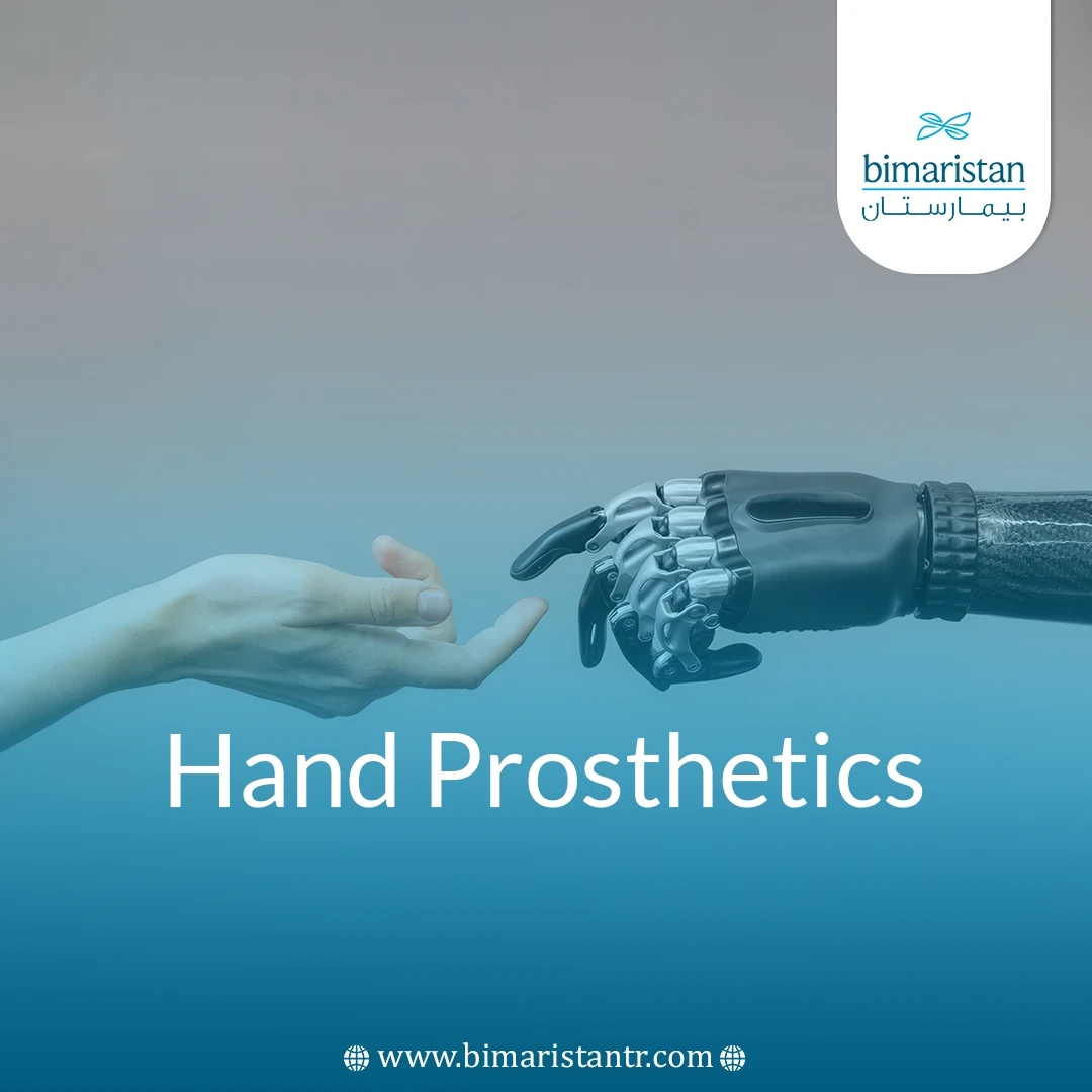 Hand Prosthetics: Types, Features, And How To Choose The Right One