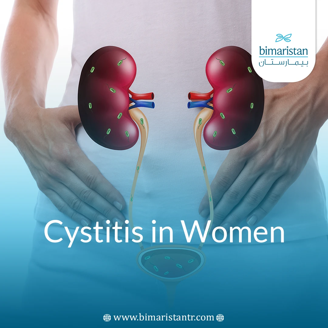 Cystitis In Women