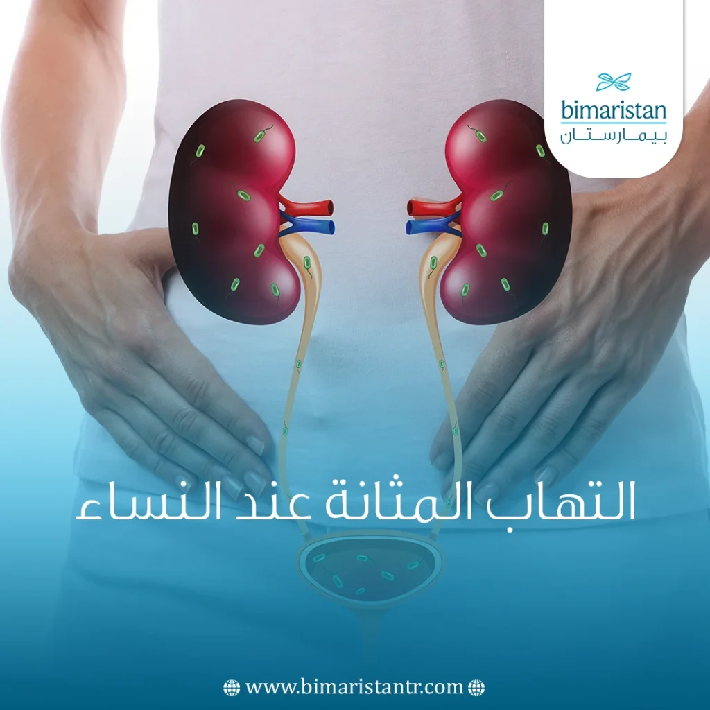 التهاب المثانة عند النساء