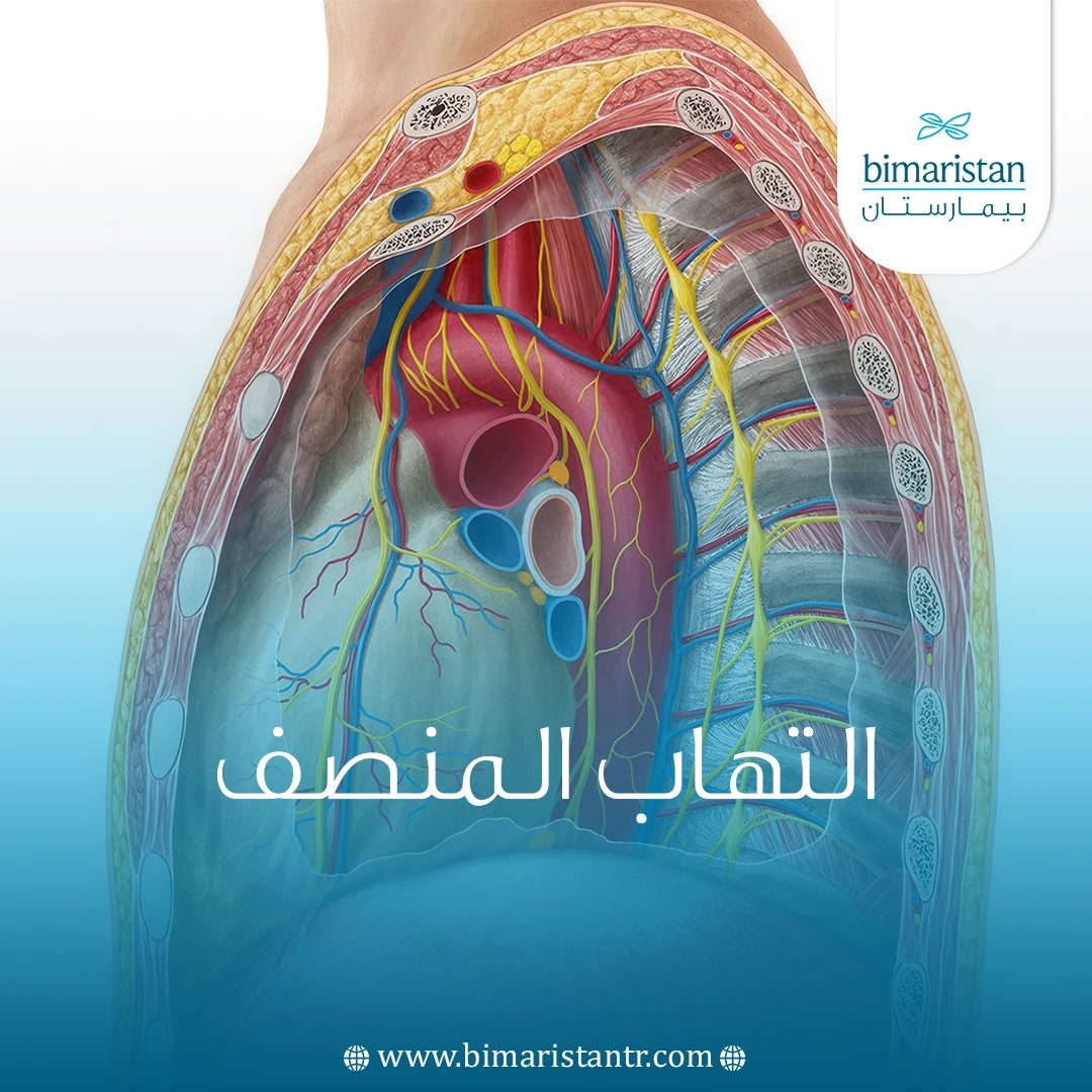 التهاب المنصف