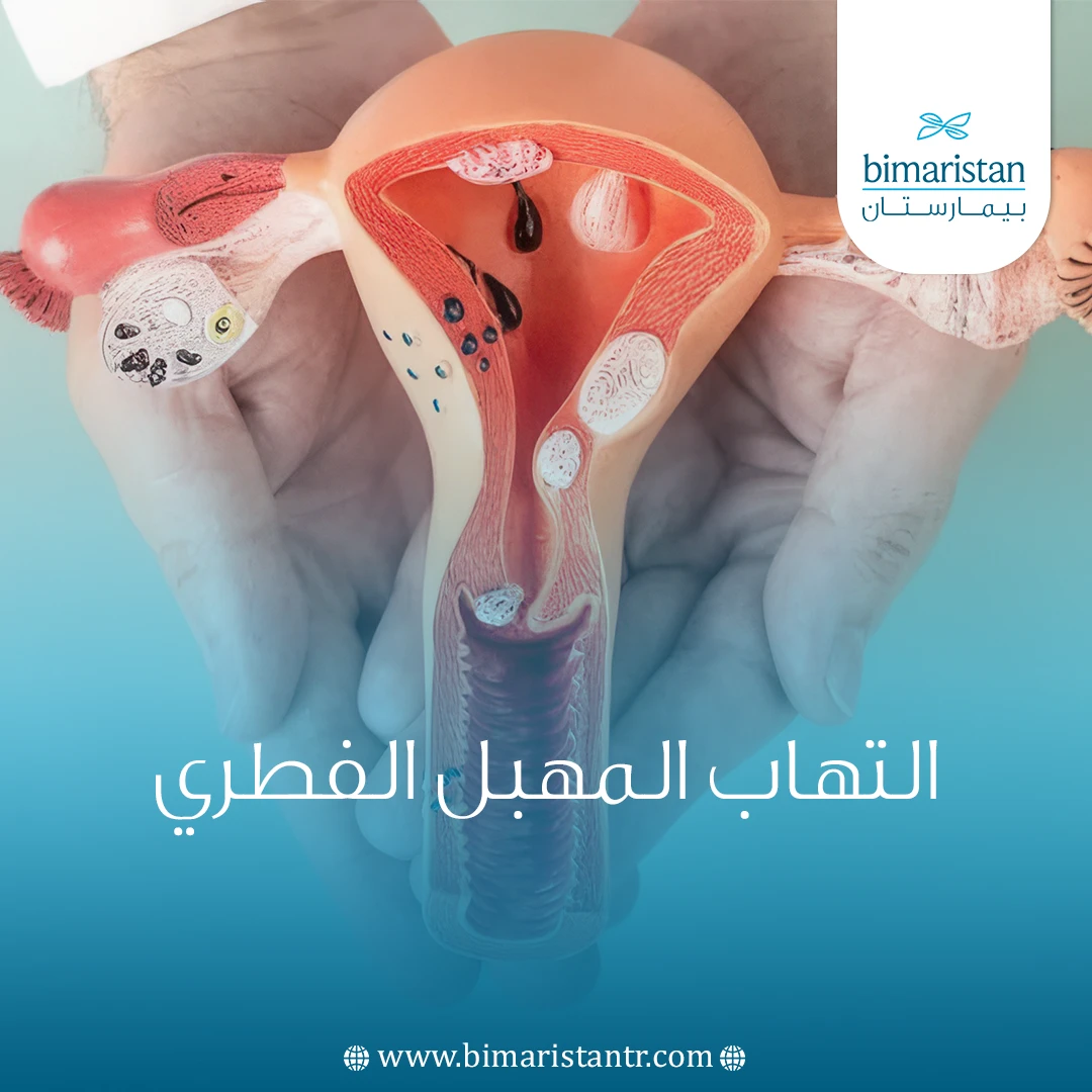 التهاب المهبل الفطري