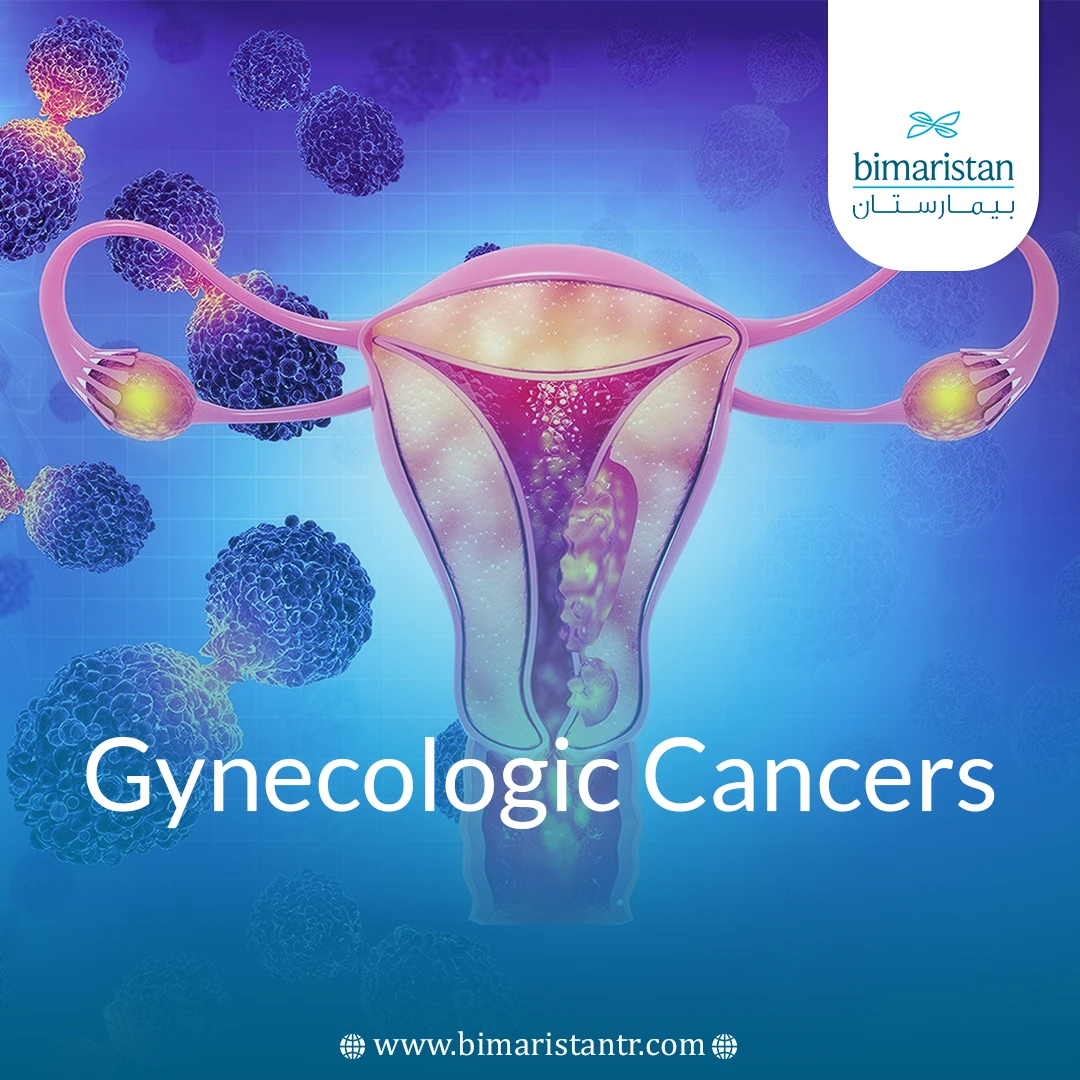 Gynecologic Cancers: Types, Causes &Amp;Amp; Treatment Options
