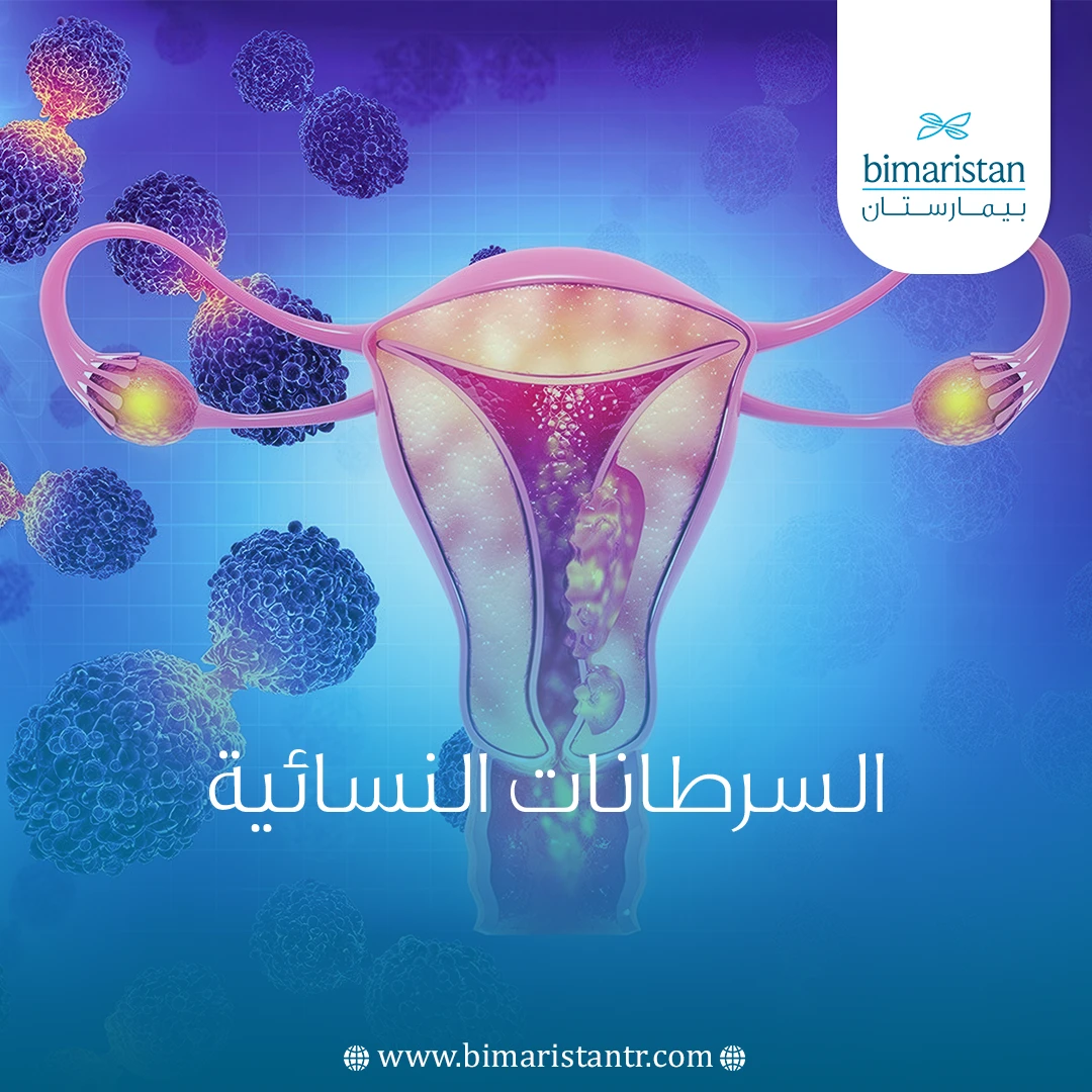 السرطانات النسائية
