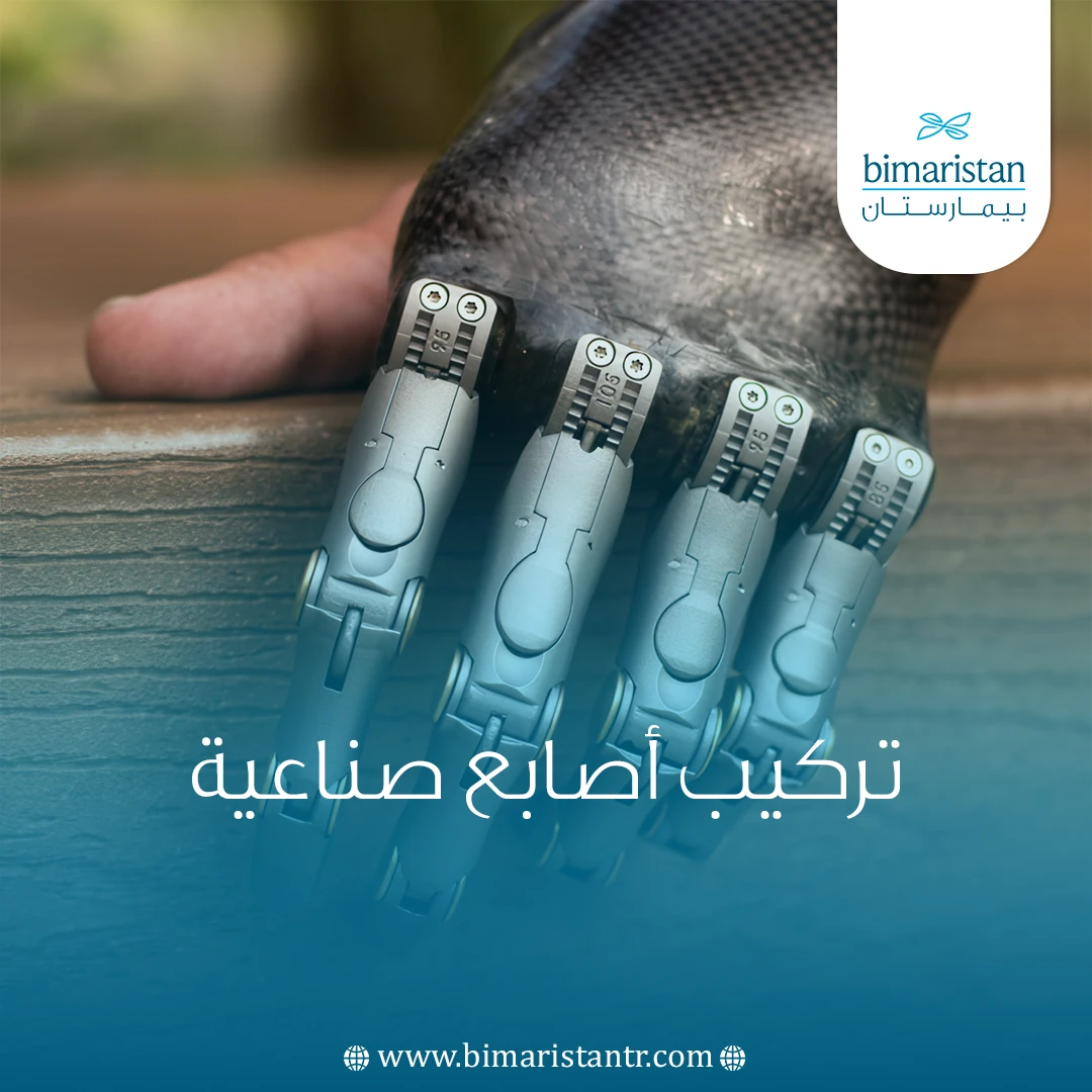 تركيب أصابع صناعية