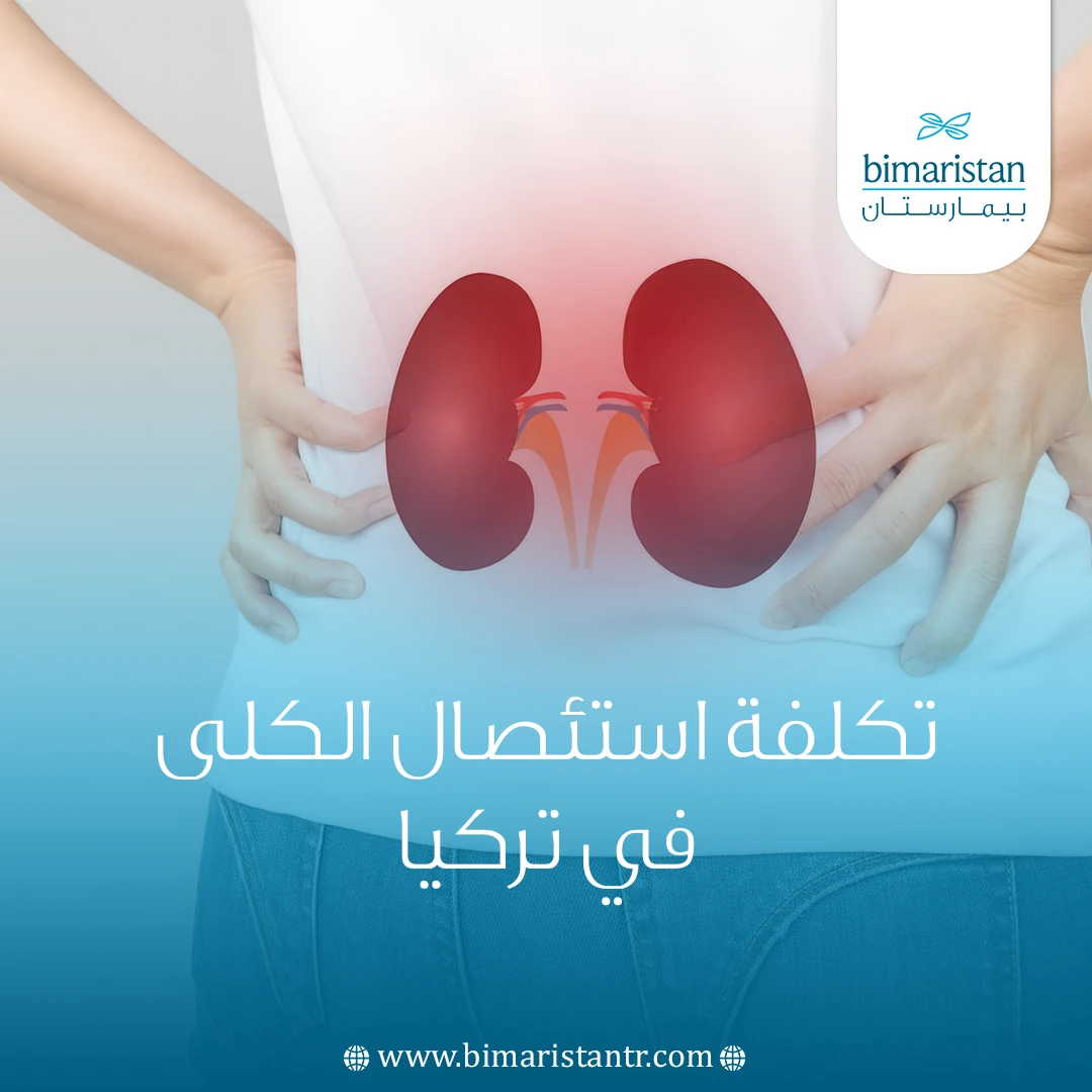 تكلفة استئصال الكلى في تركيا