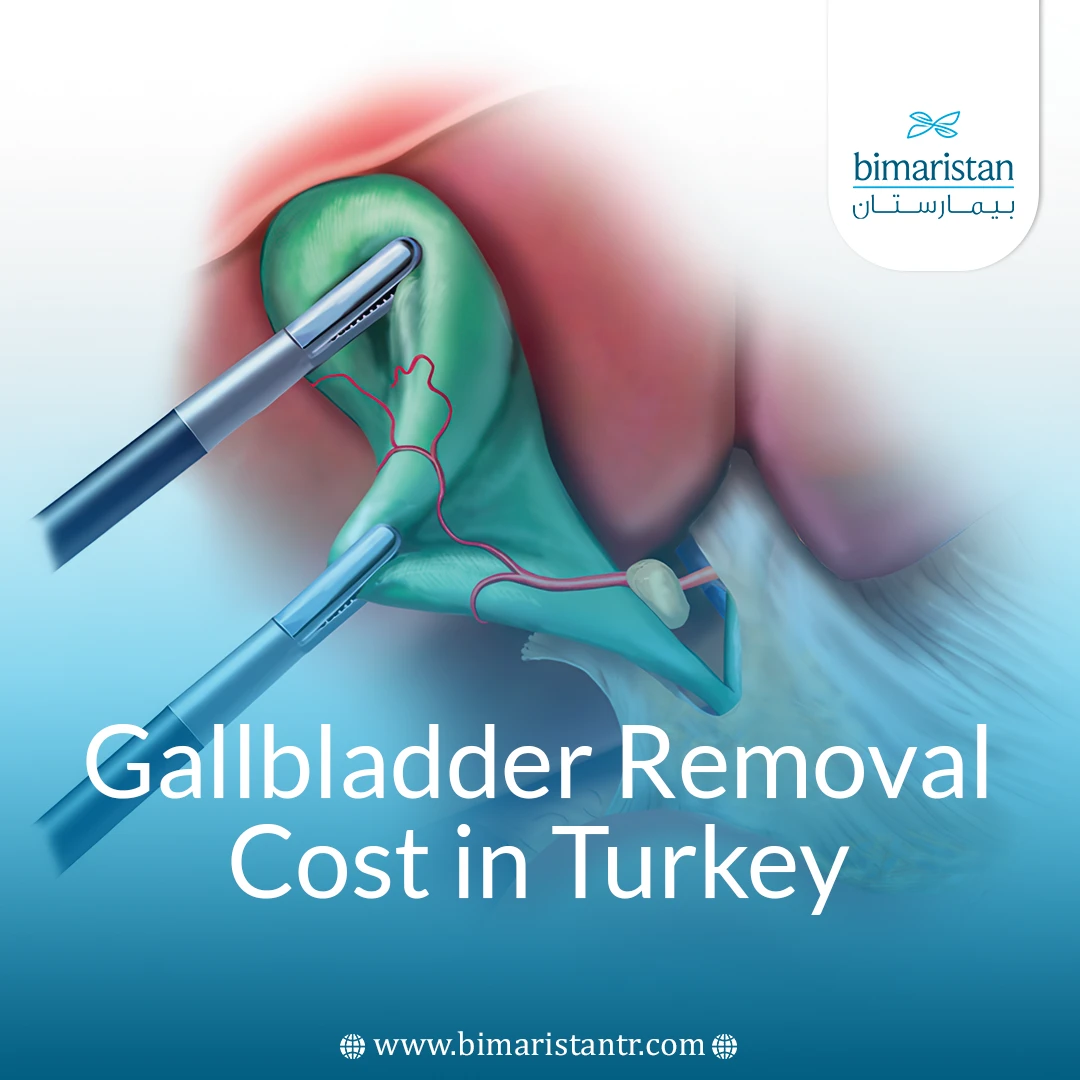 Gallbladder Removal Cost In Turkey