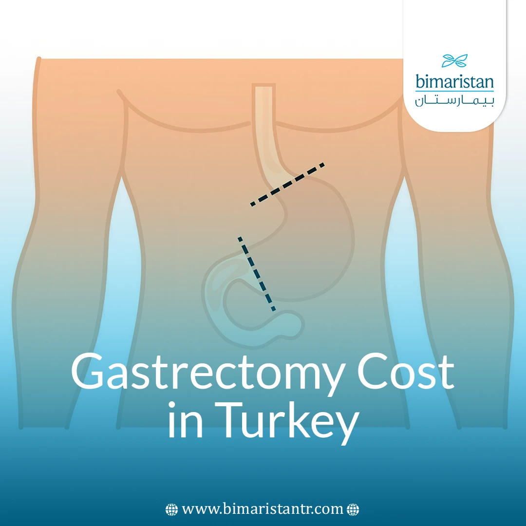 Gastrectomy Cost In Turkey: Key Facts Before You Travel
