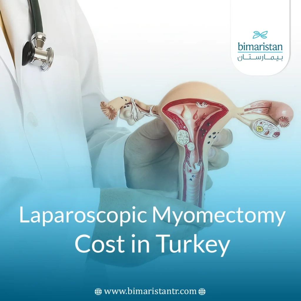 Laparoscopic Myomectomy Cost In Turket