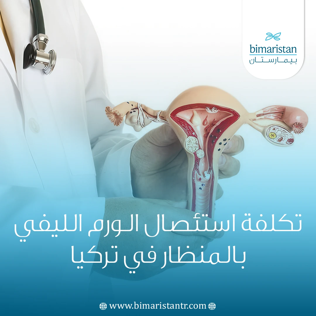 تكلفة استئصال الورم الليفي بالمنظار في تركيا: الدليل الشامل 2025