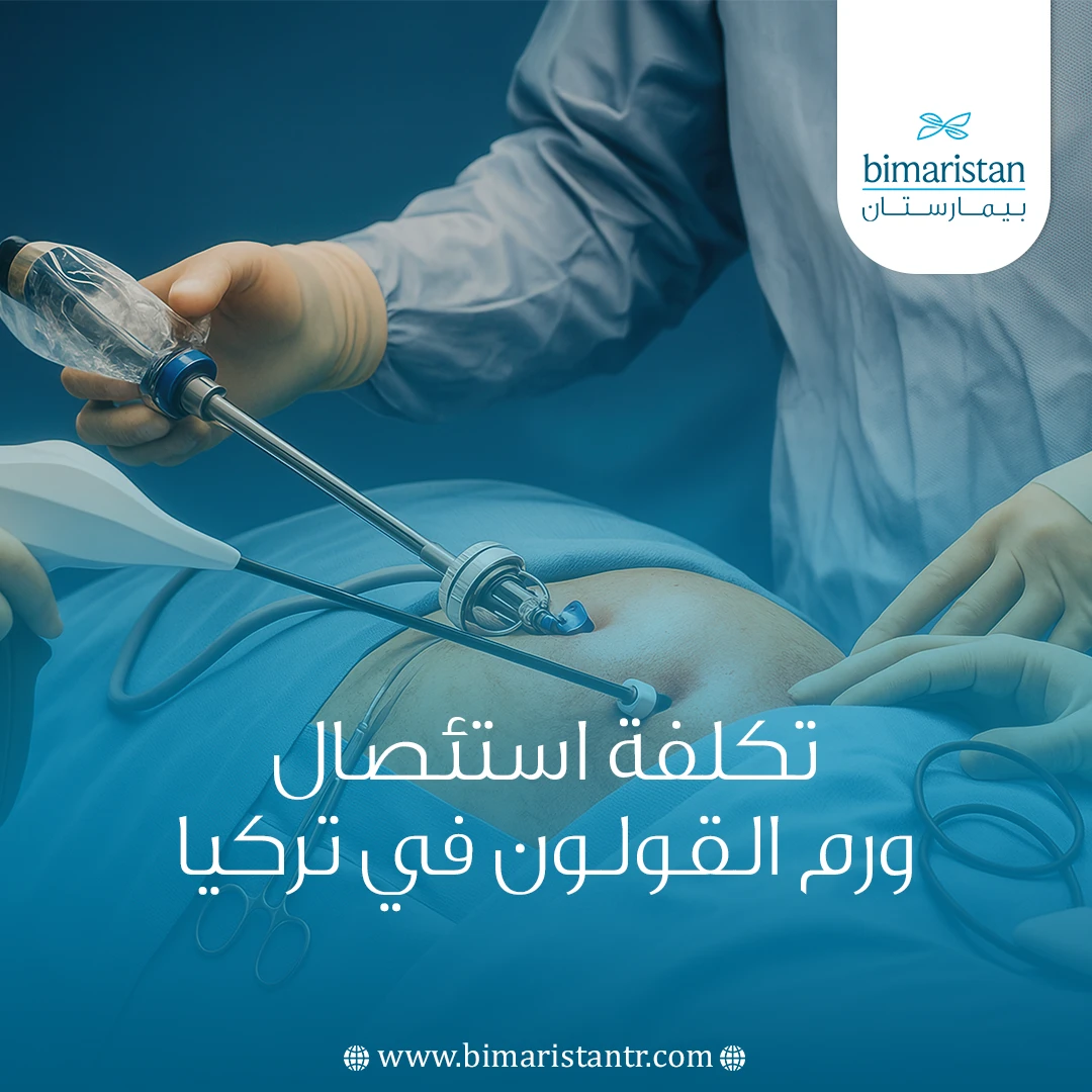 تكلفة استئصال ورم القولون في تركيا: الدليل الشامل 2025