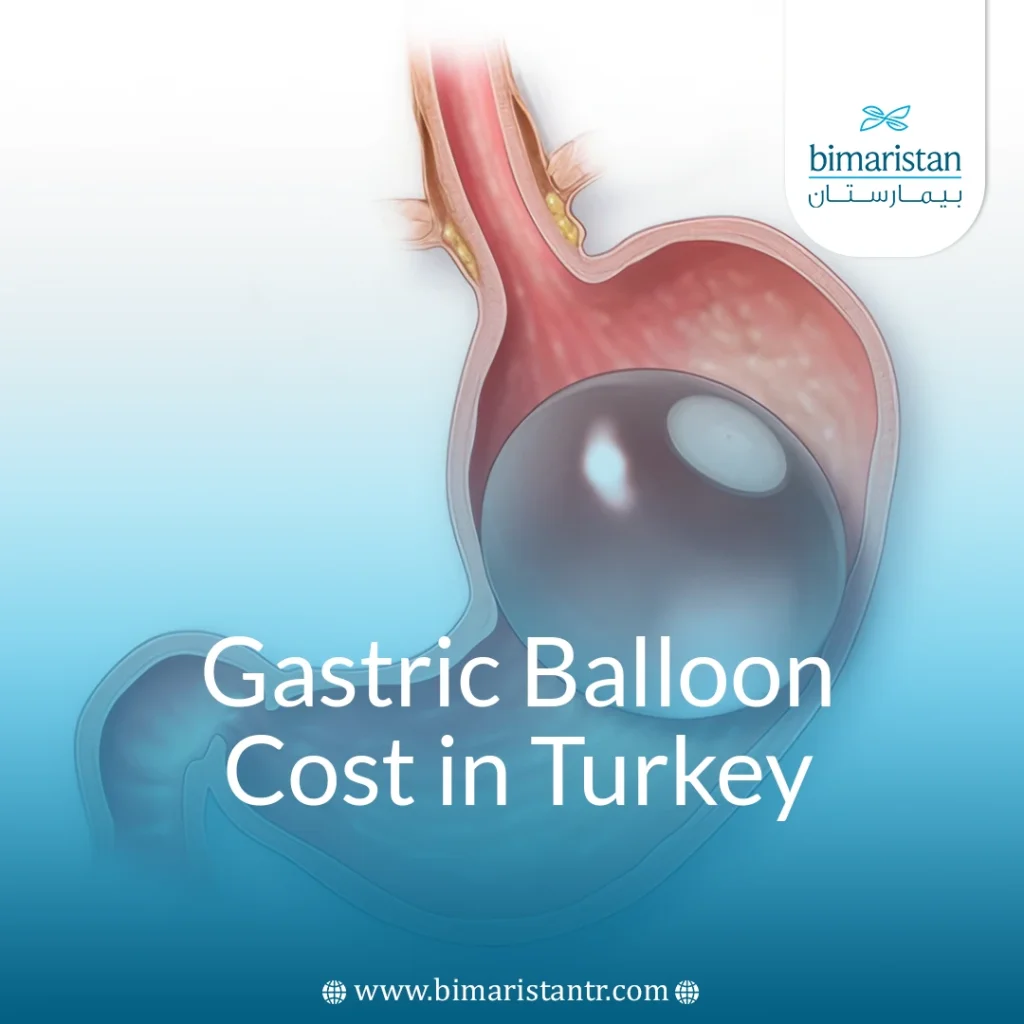 Gastric Balloon Cost In Turkey