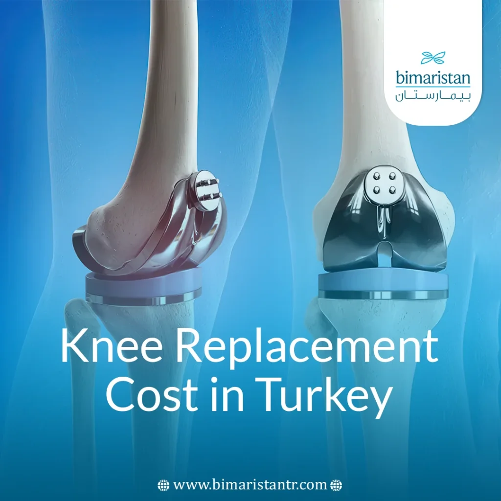Knee Replacement Cost In Turkey