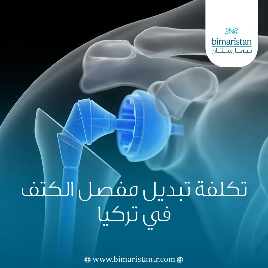 تكلفة تبديل مفصل الكتف في تركيا