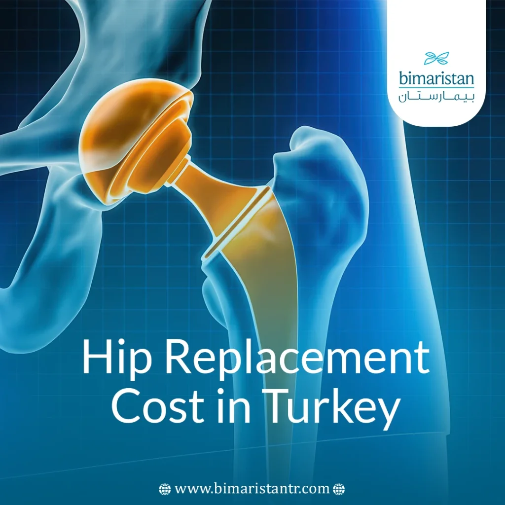Hip Replacement Cost In Turkey