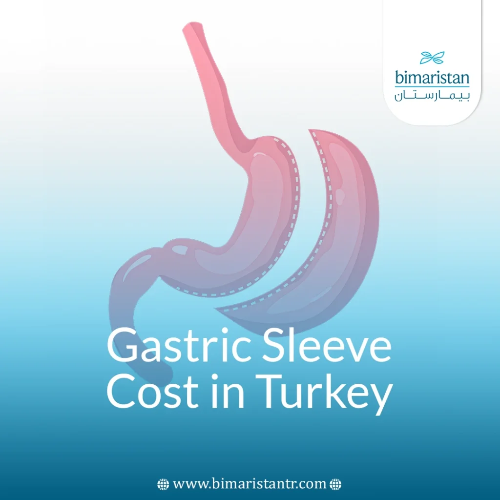 Gastric Sleeve Surgery Cost In Turkey