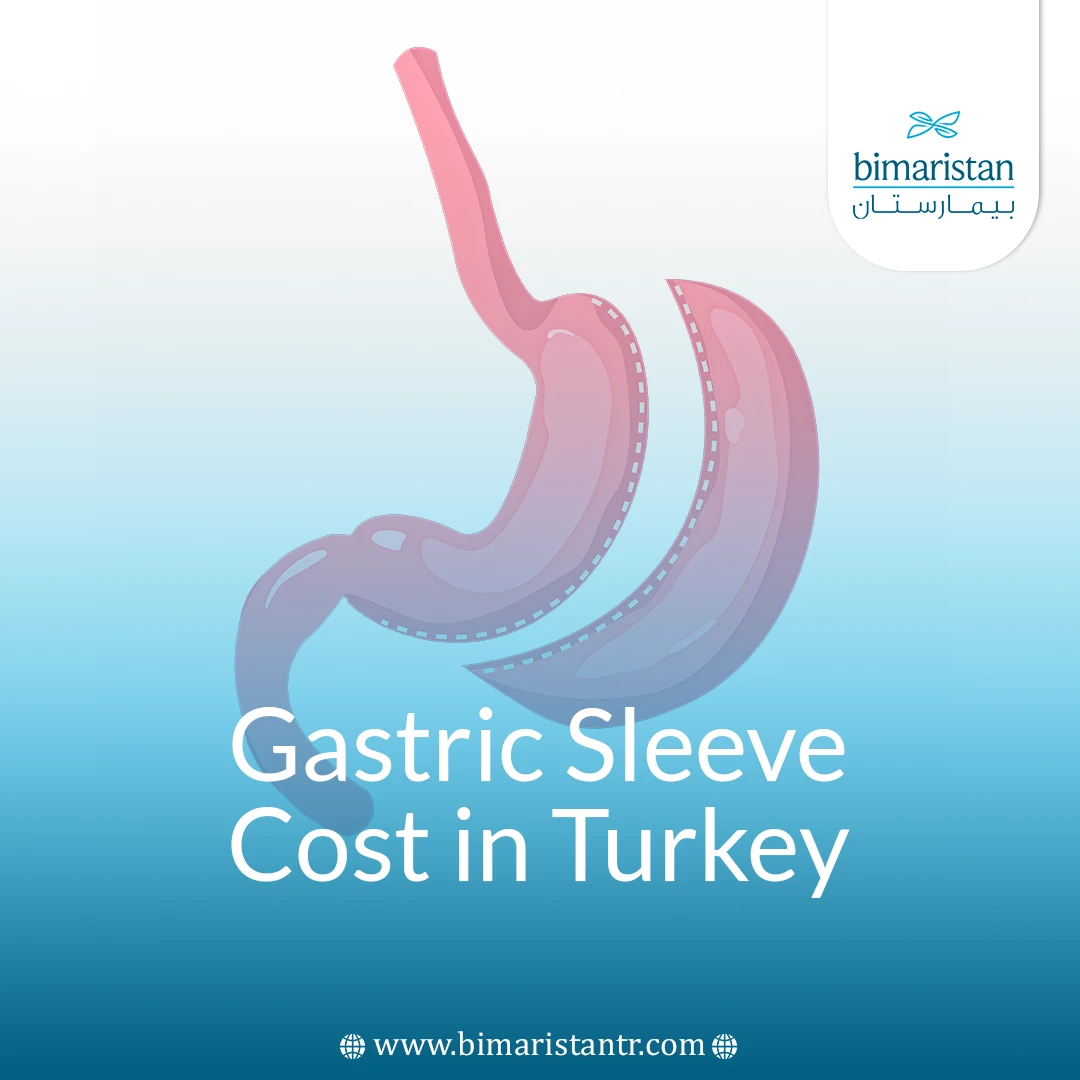 Gastric Sleeve Surgery Cost In Turkey: The Comprehensive Guide 2025