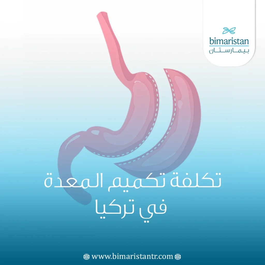 تكلفة تكميم المعدة في تركيا