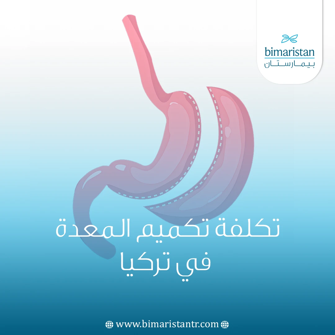 تكلفة تكميم المعدة في تركيا
