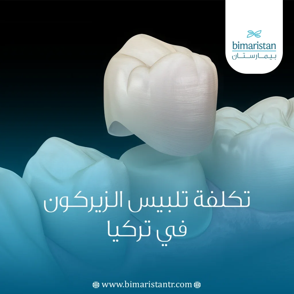 تكلفة تلبيس الزيركون في تركيا