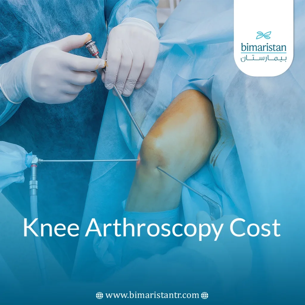 Knee Arthroscopy Cost