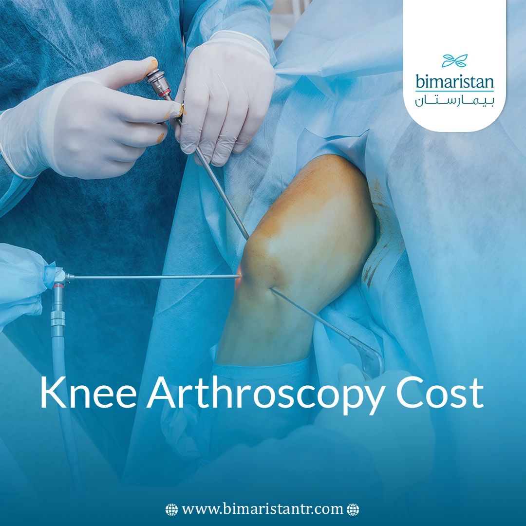 Knee Arthroscopy Cost: An Investment In Joint Health 1 Knee Arthroscopy Cost: An Investment In Joint Health