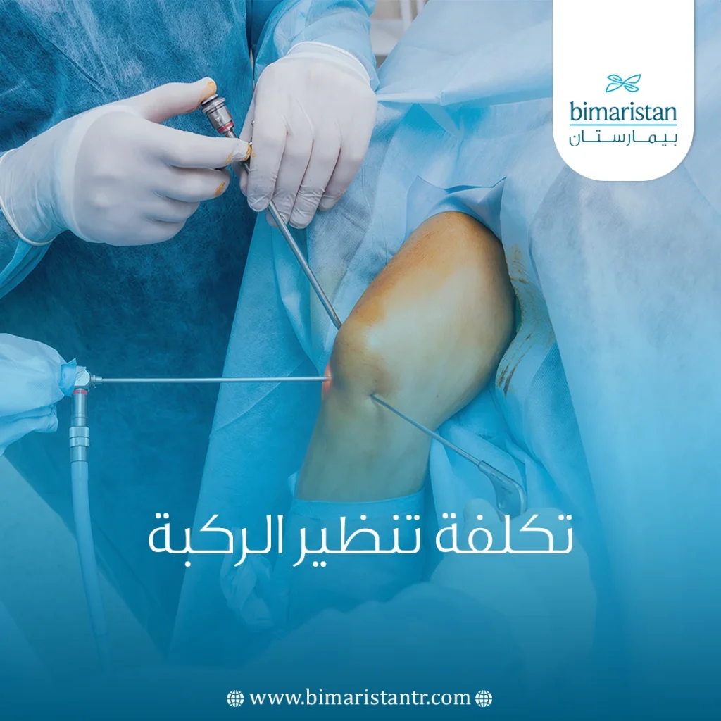تكلفة تنظير الركبة