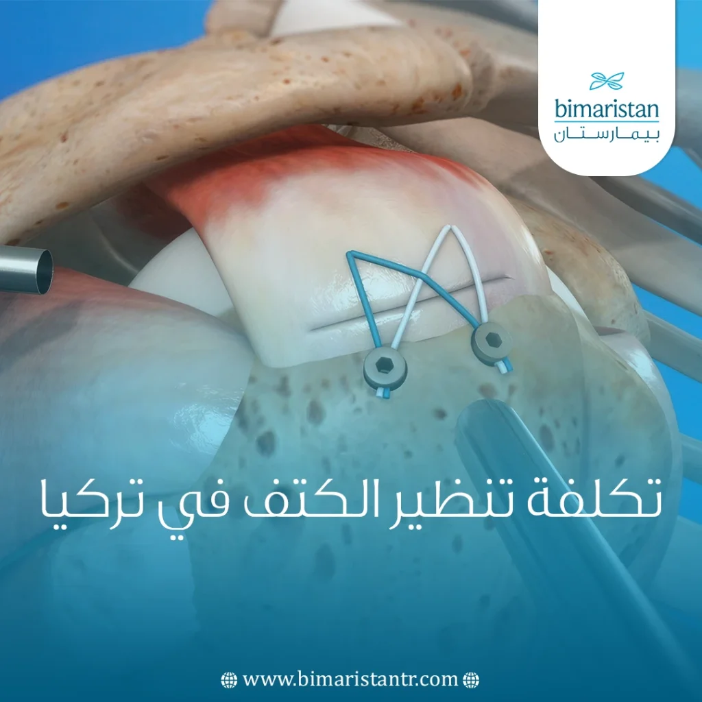 تكلفة تنظير الكتف في تركيا