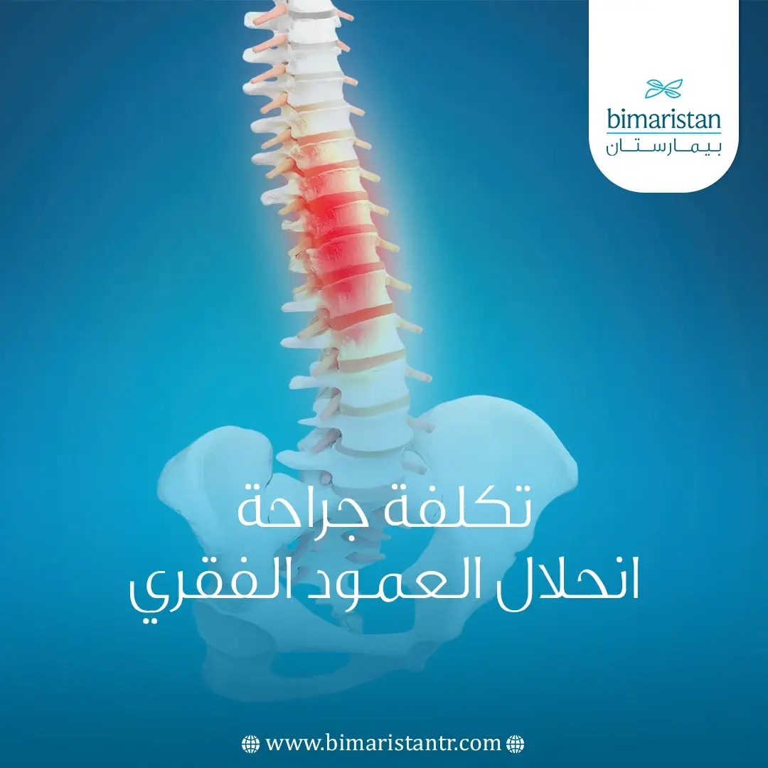 تكلفة جراحة انحلال العمود الفقري في تركيا: الدليل الشامل