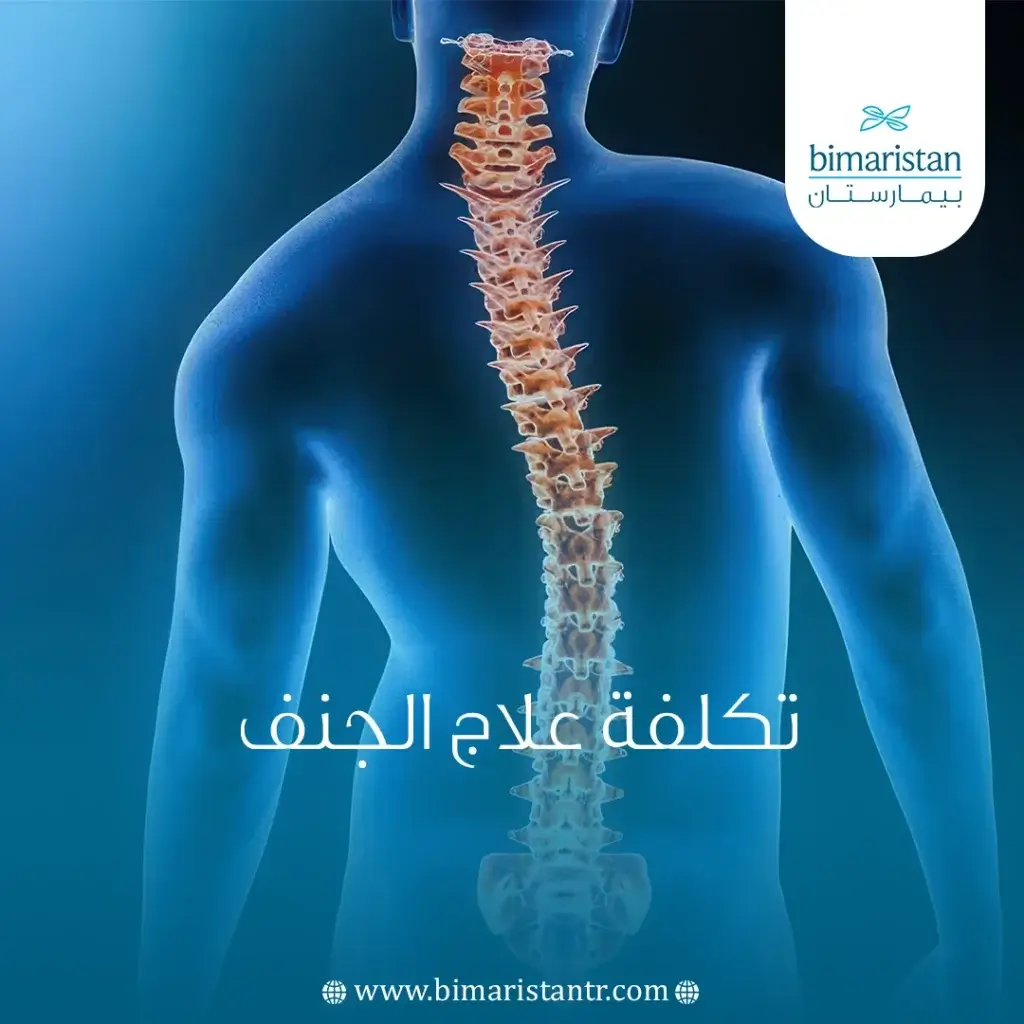 تكلفة علاج الجنف