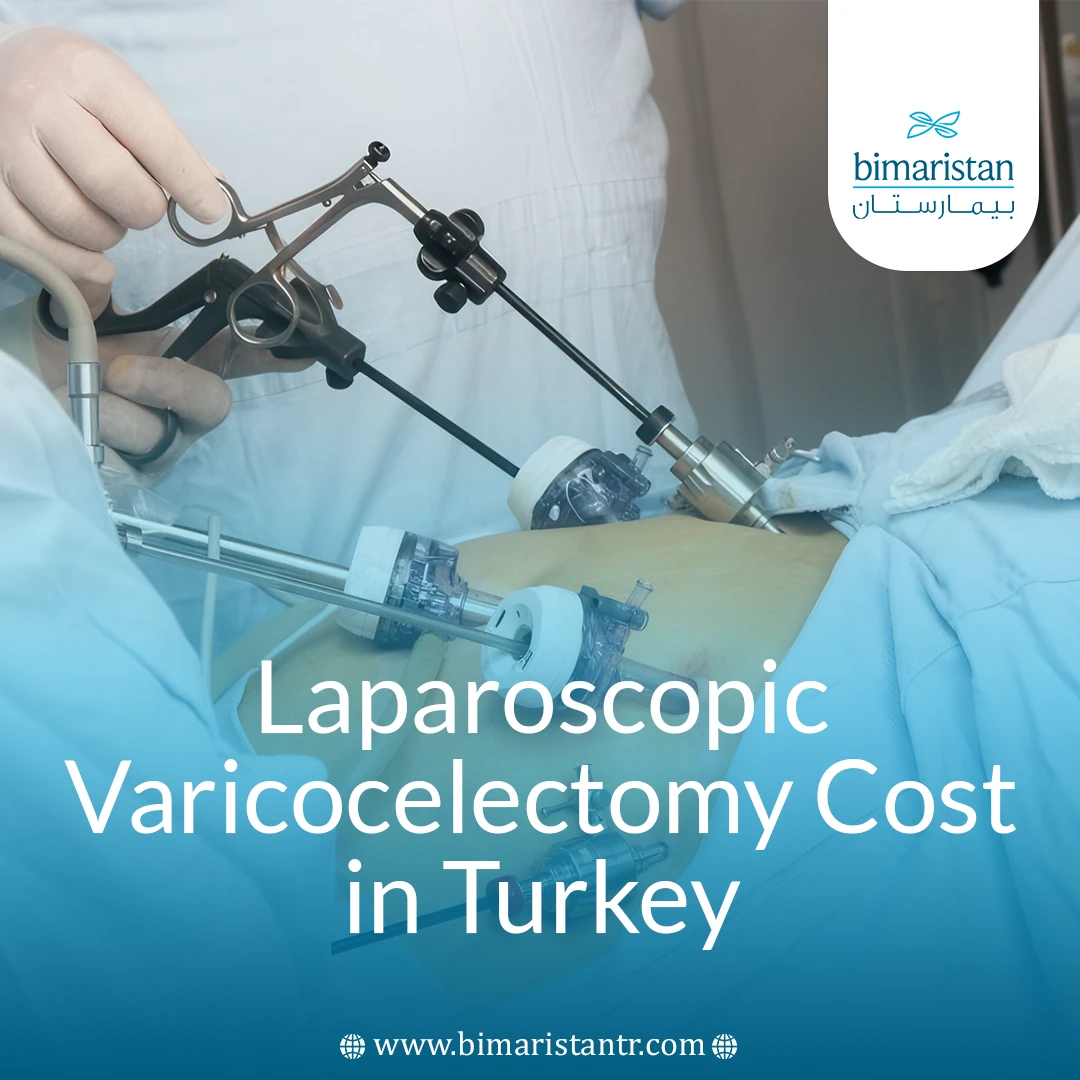 Laparoscopic Varicocelectomy Cost In Turkey: 2025 Guide