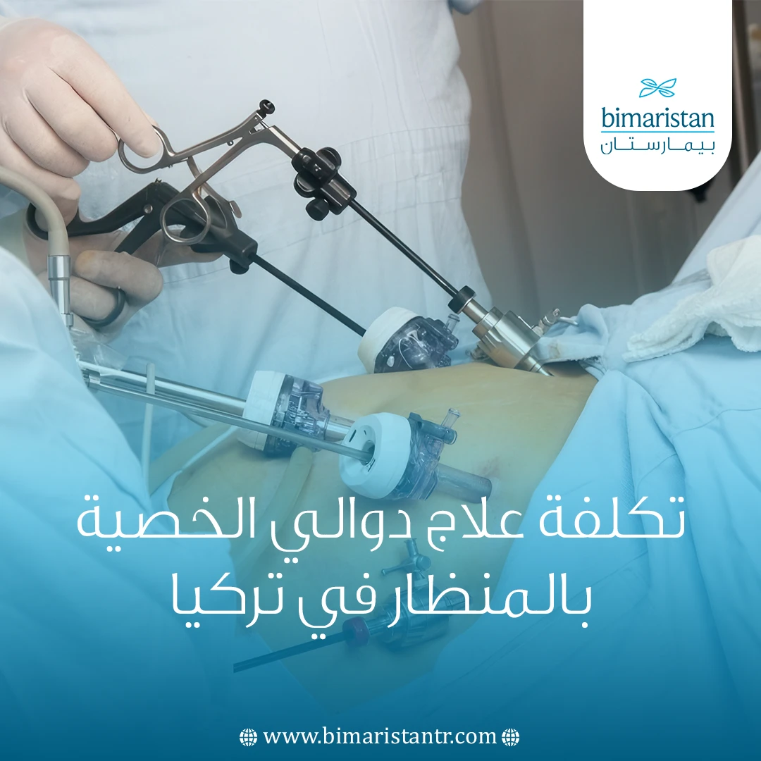 تكلفة علاج دوالي الخصية بالمنظار في تركيا