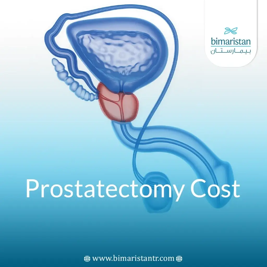 Prostatectomy Cost In Turkey: Comprehensive Guide