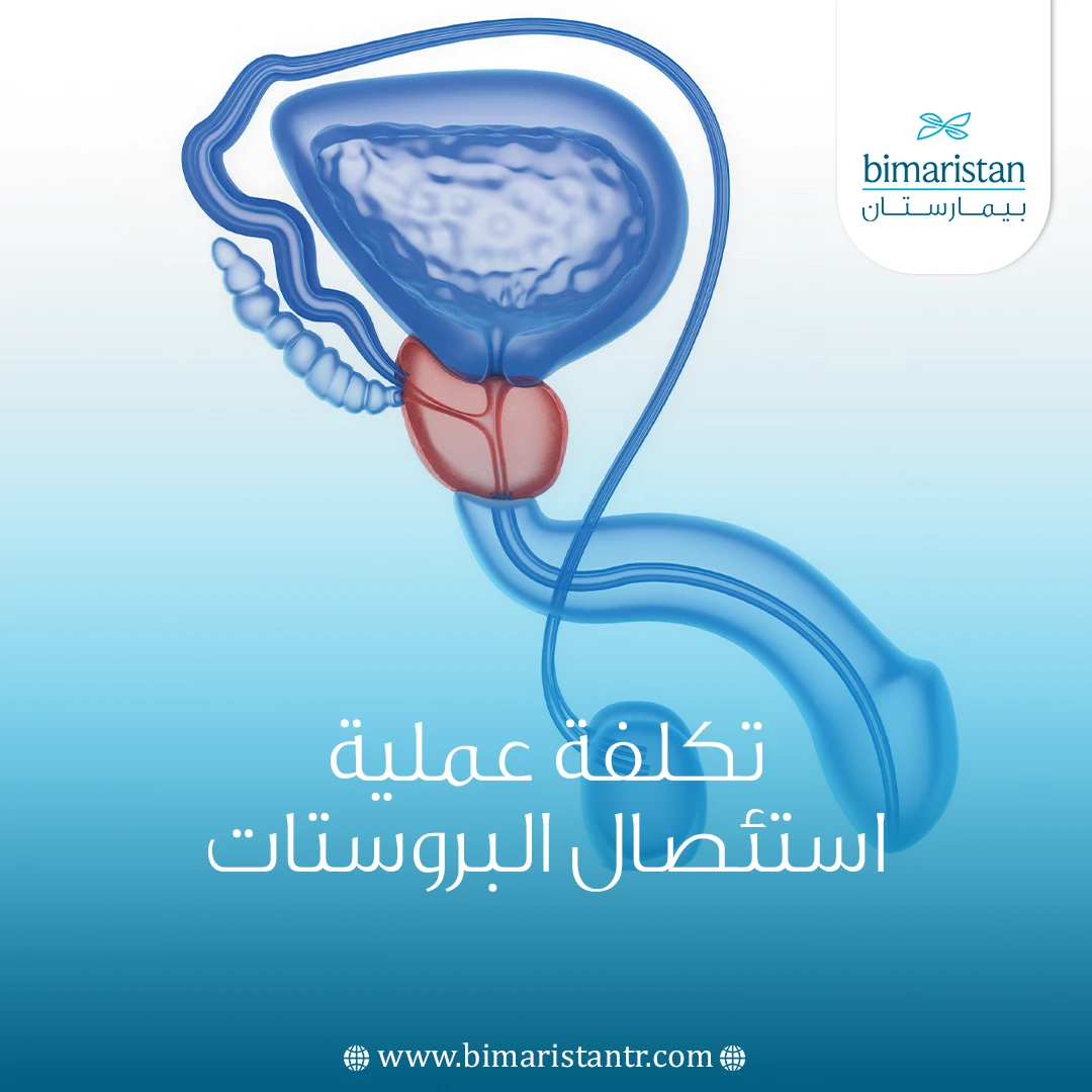 تكلفة عملية استئصال البروستات في تركيا: الدليل الشامل