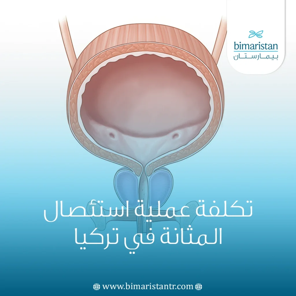 تكلفة عملية استئصال المثانة في تركيا