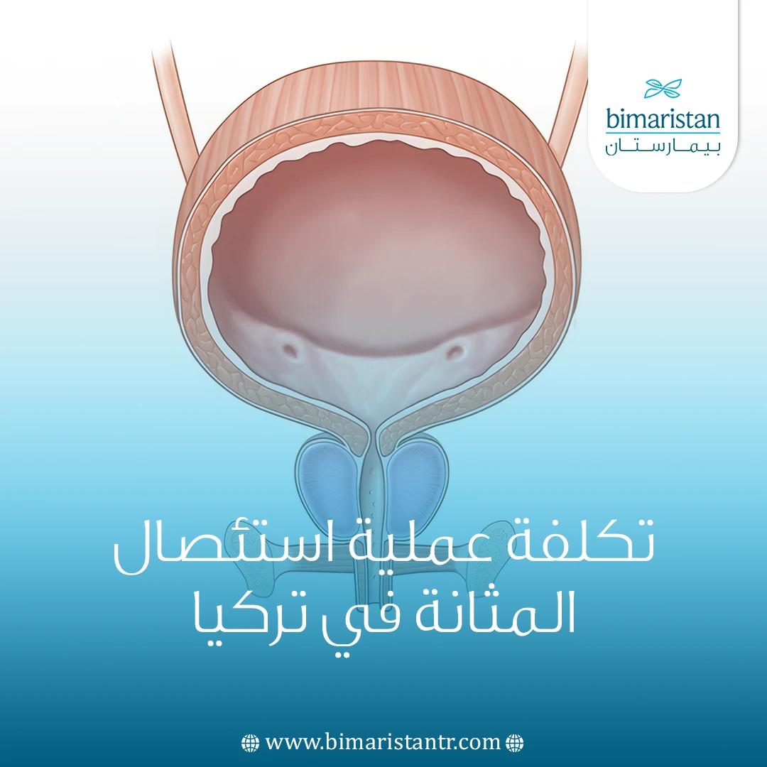 تكلفة عملية استئصال المثانة في تركيا