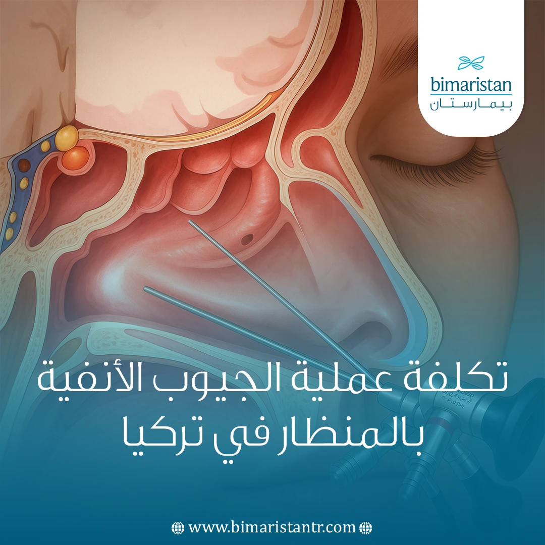 تكلفة عملية الجيوب الأنفية بالمنظار في تركيا