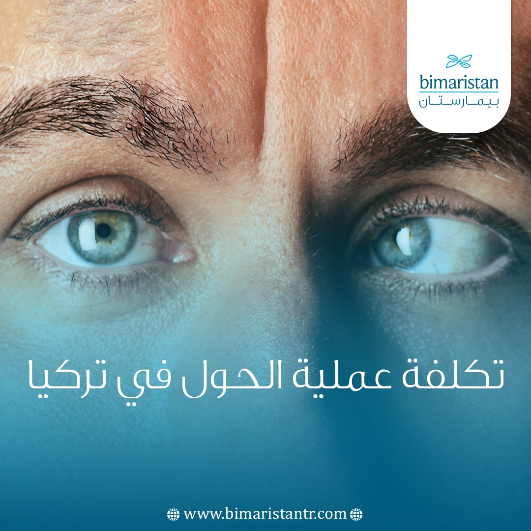 تكلفة عملية الحول في تركيا 2025: علاج مشاكل العيون بأفضل الأسعار