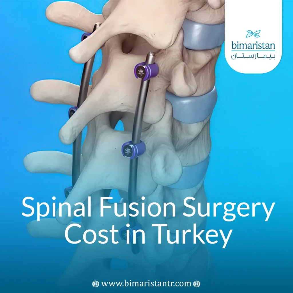 Spinal Fusion Surgery Cost In Turkey