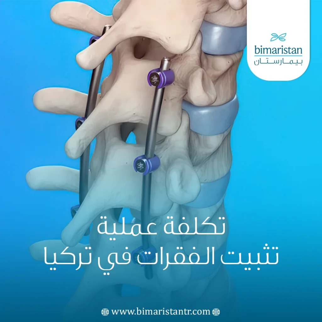 تكلفة عملية تثبيت الفقرات في تركيا