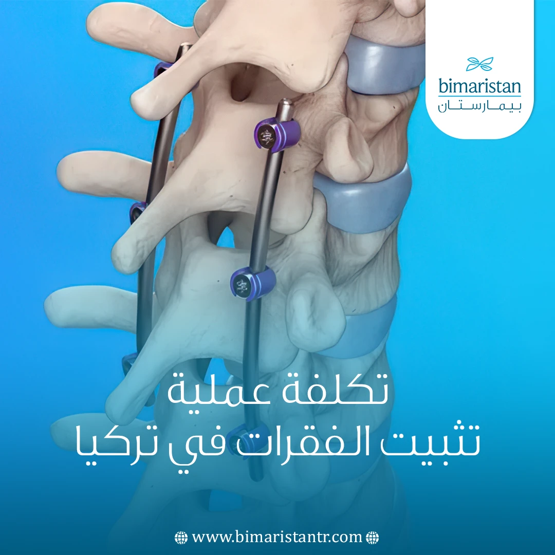 تكلفة عملية تثبيت الفقرات في تركيا
